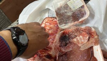 ضبط لحوم ودواجن غير صالحة للاستهلاك الآدمى بالغربية..