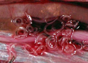 خطورة إستهلاك الأسماك المصابة بطفيل الأنيساكس على صحة الأنسان