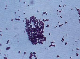 خطورة تواجد ميكروب ستاف اوريس وسمومها في الاغذية