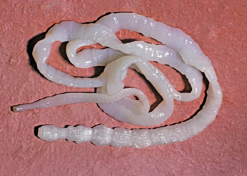 أهم الأمراض التي تنتقل إلى الإنسان عن طريق اللحوم